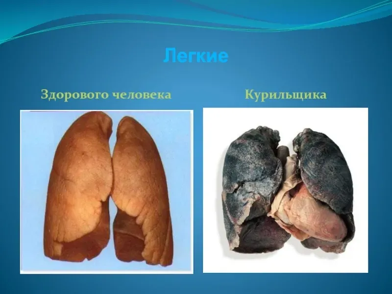 Bronhomin : sastav samo prirodnih sastojaka.