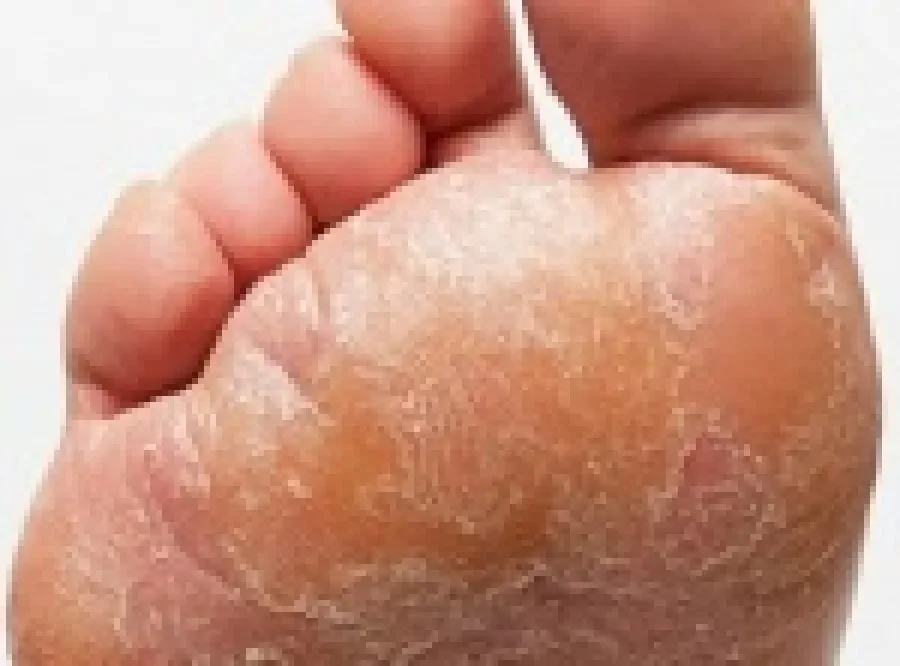 Noktal gel : sastav samo prirodnih sastojaka.
